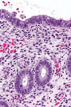 Endometrio en fase proliferativa - mag.jpg alta