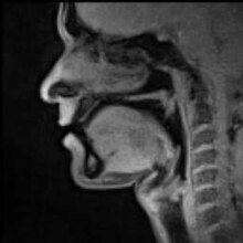 Archivo: MRI en tiempo real - Hablando (inglés) .ogv