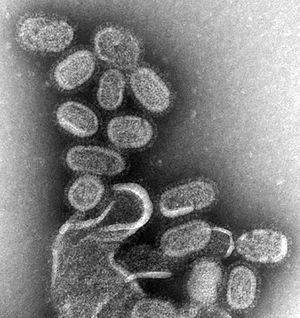 EM ของไวรัสไข้หวัดใหญ่. jpg