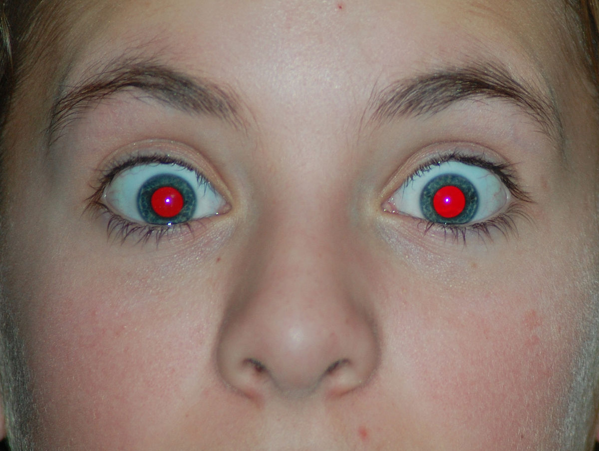 الحمراء سبب العيون احمرار العين