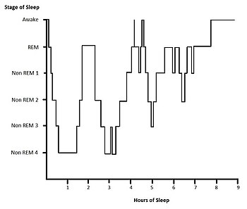 Example hypnogram for a normal, healthy adult. Within the first hour of sleep SWS is displayed. Cycles of REM and NREM sleep proceed. During the third cycle of sleep there are two brief wake states. During the second half of the sleep period more REM sleep is displayed and there is little SWS detected.